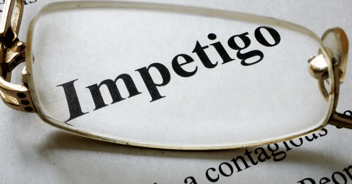 Impetigo in Dogs: All You Need To Know | World Dog Finder