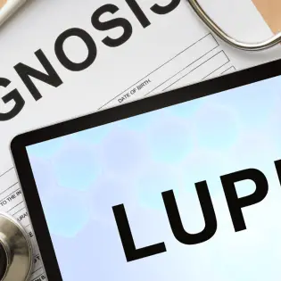 Lupus in Dogs | Symptoms & Treatment